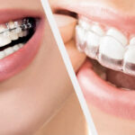 Orthodontics