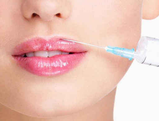 lip reshaping surgery