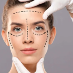 facelift in Adelaide