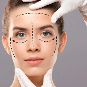 facelift in Adelaide