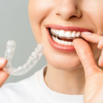 best aligners for teeth
